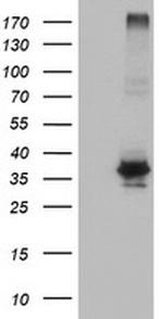 OSGEP Antibody in Western Blot (WB)