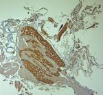 HOMER1 Antibody in Immunohistochemistry (Paraffin) (IHC (P))