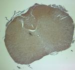 HOMER2 Antibody in Immunohistochemistry (Paraffin) (IHC (P))