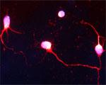 Huntingtin Antibody in Immunocytochemistry (ICC/IF)