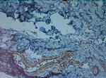 HIF1 alpha Antibody in Immunohistochemistry (Paraffin) (IHC (P))