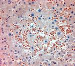 MPR 300 Antibody in Immunohistochemistry (Paraffin) (IHC (P))