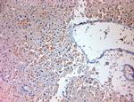 MPR 300 Antibody in Immunohistochemistry (Paraffin) (IHC (P))