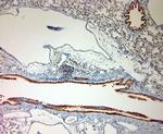 MPR 300 Antibody in Immunohistochemistry (Paraffin) (IHC (P))