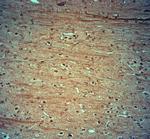 KCNJ10 Antibody in Immunohistochemistry (Paraffin) (IHC (P))