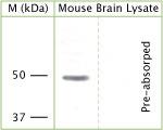 KCNJ12 Antibody in Western Blot (WB)