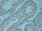 KCNJ13 Antibody in Immunohistochemistry (Paraffin) (IHC (P))