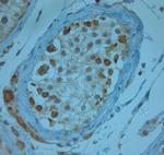 KCNJ13 Antibody in Immunohistochemistry (Paraffin) (IHC (P))