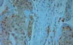 KCNJ13 Antibody in Immunohistochemistry (Paraffin) (IHC (P))