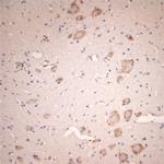 Lamp1 Antibody in Immunohistochemistry (Paraffin) (IHC (P))