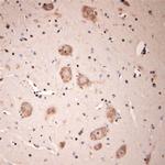 Lamp1 Antibody in Immunohistochemistry (Paraffin) (IHC (P))