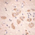 Lamp1 Antibody in Immunohistochemistry (Paraffin) (IHC (P))