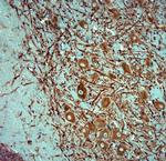 MAP2 Antibody in Immunohistochemistry (Paraffin) (IHC (P))