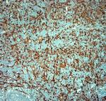 MAP2 Antibody in Immunohistochemistry (Paraffin) (IHC (P))