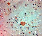 Mortalin Antibody in Immunohistochemistry (Paraffin) (IHC (P))