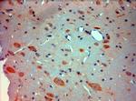 Mortalin Antibody in Immunohistochemistry (Paraffin) (IHC (P))