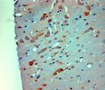 Mortalin Antibody in Immunohistochemistry (Paraffin) (IHC (P))