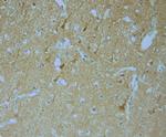 MPP1 Antibody in Immunohistochemistry (Paraffin) (IHC (P))