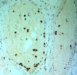 MPO Antibody in Immunohistochemistry (Paraffin) (IHC (P))