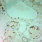 MPO Antibody in Immunohistochemistry (Paraffin) (IHC (P))