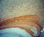 MBP Antibody in Immunohistochemistry (Paraffin) (IHC (P))