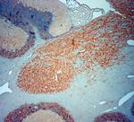 MAP2 Antibody in Immunohistochemistry (Paraffin) (IHC (P))