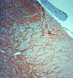 MAP2 Antibody in Immunohistochemistry (Paraffin) (IHC (P))