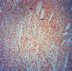 MAP2 Antibody in Immunohistochemistry (Paraffin) (IHC (P))