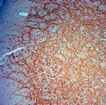 MAP2 Antibody in Immunohistochemistry (Paraffin) (IHC (P))