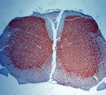 MAP2 Antibody in Immunohistochemistry (Paraffin) (IHC (P))