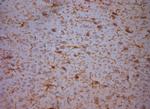 NG2 Antibody in Immunohistochemistry (Paraffin) (IHC (P))