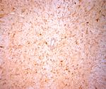 NG2 Antibody in Immunohistochemistry (Paraffin) (IHC (P))