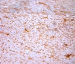 NG2 Antibody in Immunohistochemistry (Paraffin) (IHC (P))