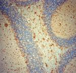 NG2 Antibody in Immunohistochemistry (Paraffin) (IHC (P))