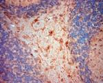 NG2 Antibody in Immunohistochemistry (Paraffin) (IHC (P))