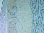 NMDAR3A Antibody in Immunohistochemistry (Paraffin) (IHC (P))