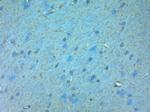 NMDAR3A Antibody in Immunohistochemistry (Paraffin) (IHC (P))