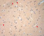 NGF Antibody in Immunohistochemistry (Paraffin) (IHC (P))