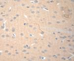 NGF Antibody in Immunohistochemistry (Paraffin) (IHC (P))