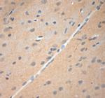 NGF Antibody in Immunohistochemistry (Paraffin) (IHC (P))