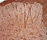 200 Neurofilament Antibody in Immunohistochemistry (Paraffin) (IHC (P))