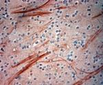 200 Neurofilament Antibody in Immunohistochemistry (Paraffin) (IHC (P))