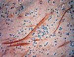 200 Neurofilament Antibody in Immunohistochemistry (Paraffin) (IHC (P))