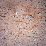 200 Neurofilament Antibody in Immunohistochemistry (Paraffin) (IHC (P))