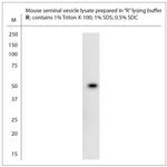 NMBR Antibody in Western Blot (WB)