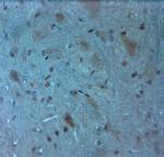 Orexin R2 Antibody in Immunohistochemistry (Paraffin) (IHC (P))