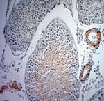 Optineurin Antibody in Immunohistochemistry (Paraffin) (IHC (P))