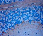 P2RX7 Antibody in Immunohistochemistry (Paraffin) (IHC (P))