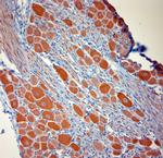 P2RX7 Antibody in Immunohistochemistry (Paraffin) (IHC (P))