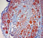 P2RX7 Antibody in Immunohistochemistry (Paraffin) (IHC (P))